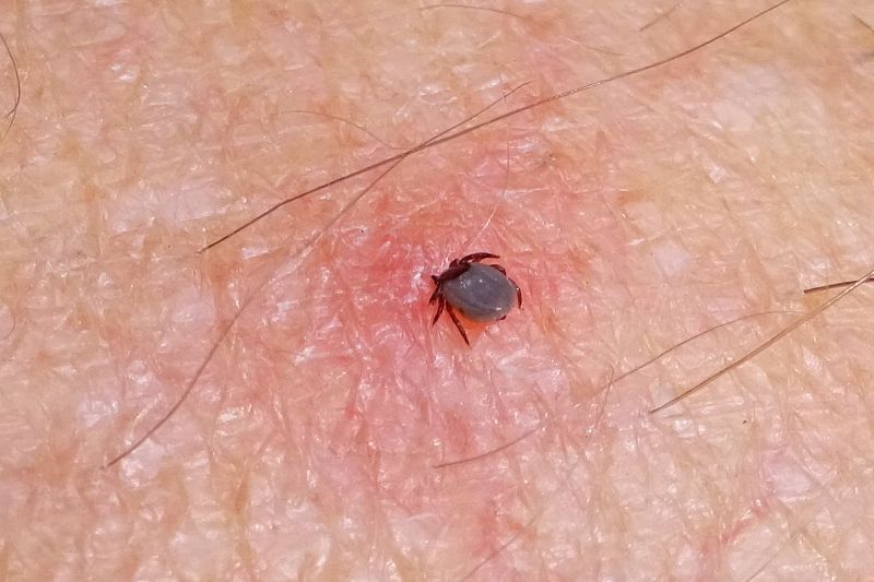 How To Remove A Dead Tick Head HOWOTRE