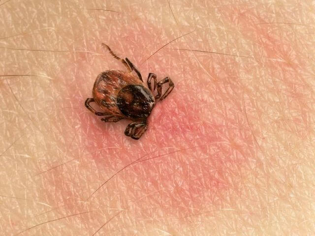 how does a tick bite look