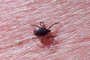 how to remove a tick from a person