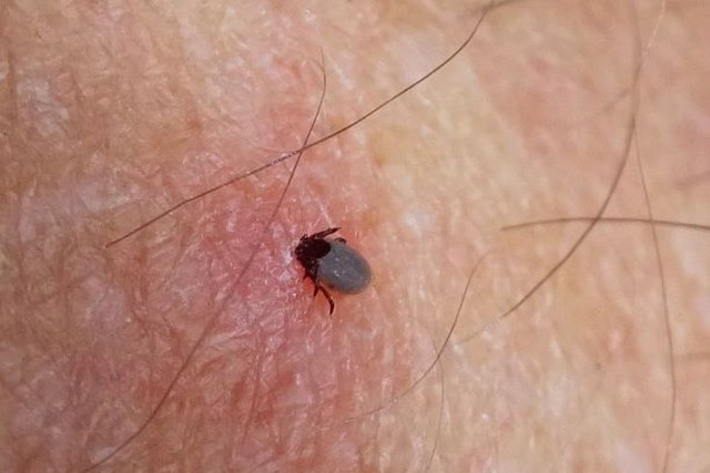 what does a tick bite look like